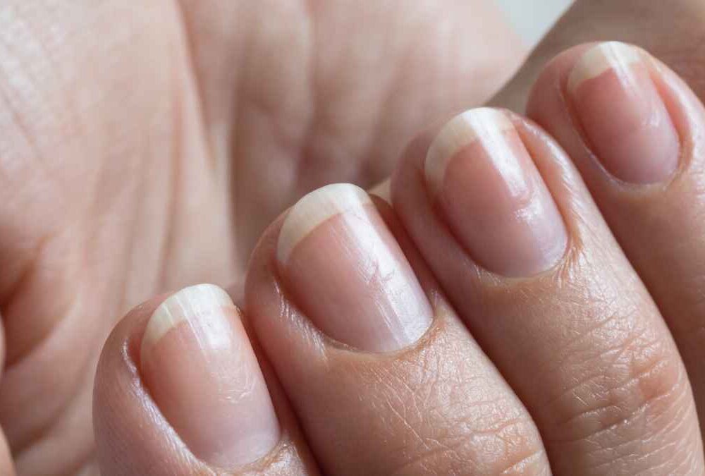 ArrayPatch Announces First Close