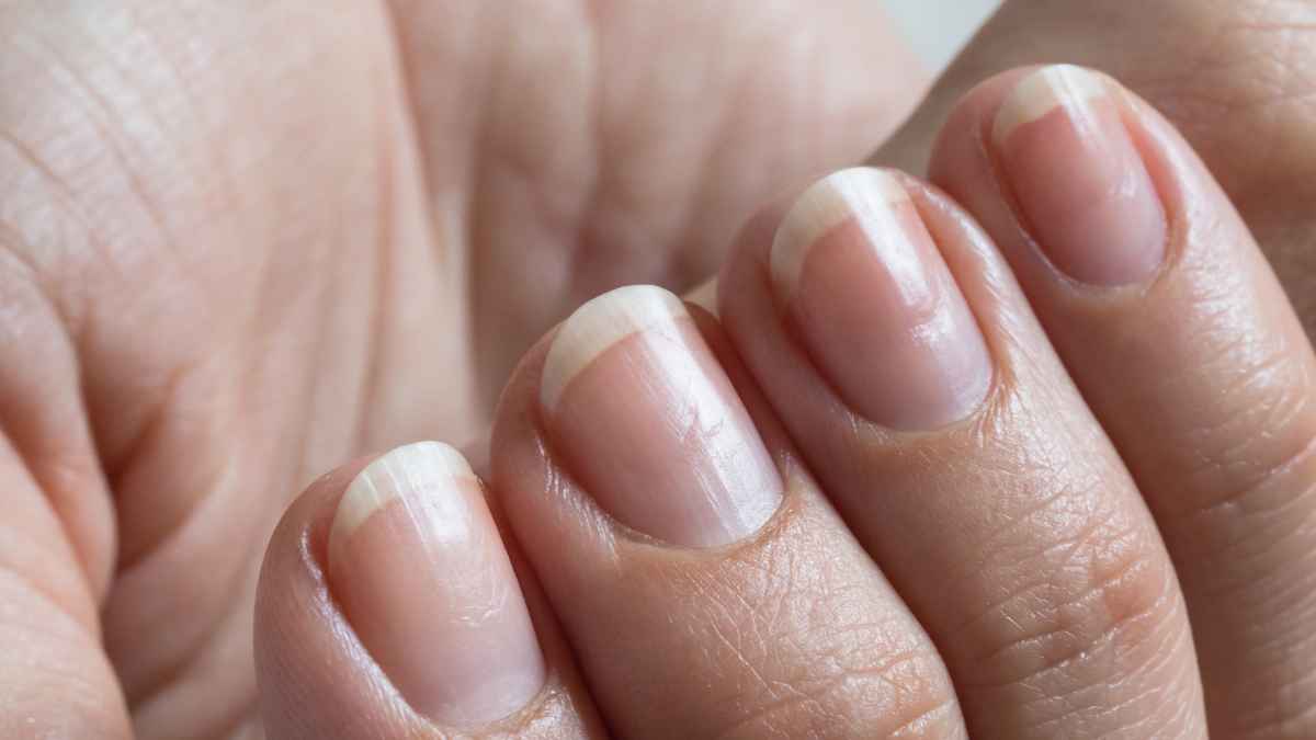 ArrayPatch Announces First Close