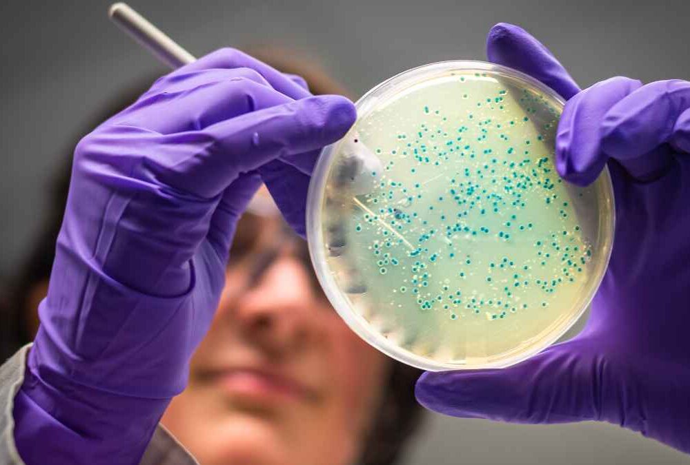 Gut microbiota testing