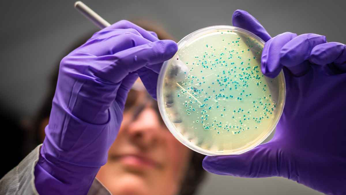 Gut microbiota testing