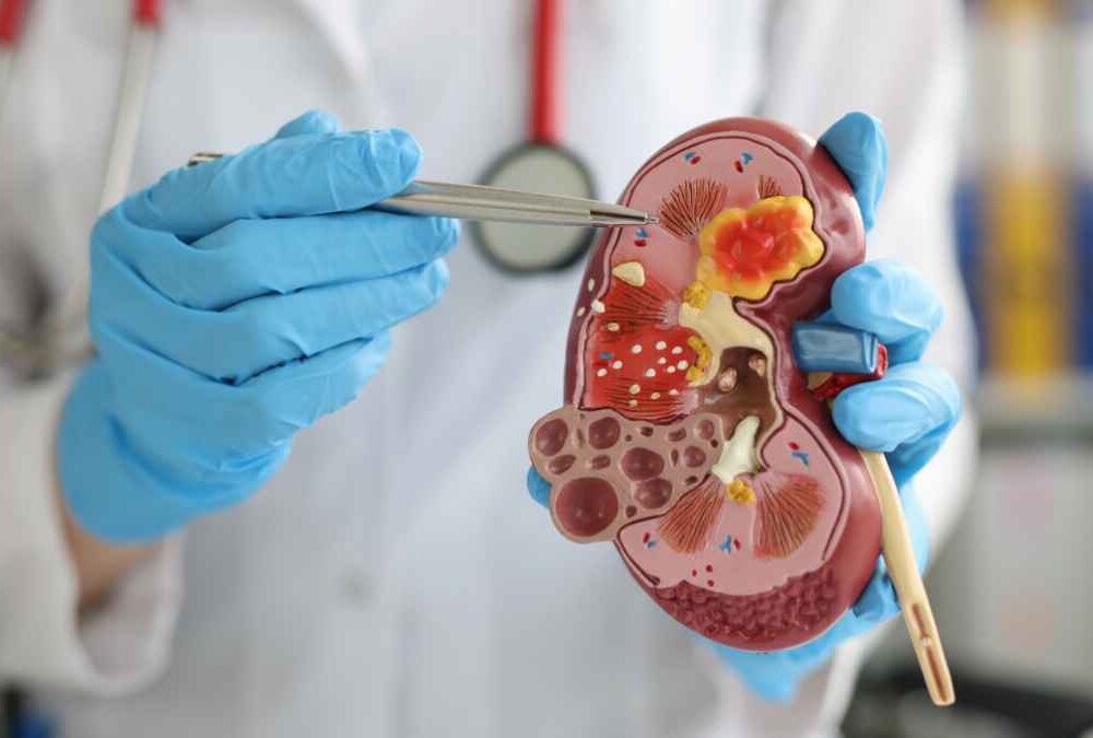 University of Chicago Urologist