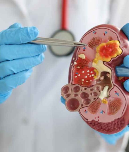 University of Chicago Urologist