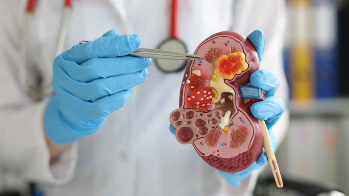 University of Chicago Urologist