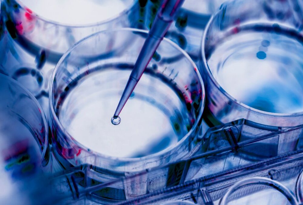 IntelliGenome Appoints ILEX