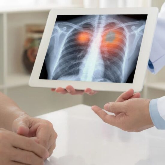 Piedmont to Launch Lung Transplant Program, Expanding Other