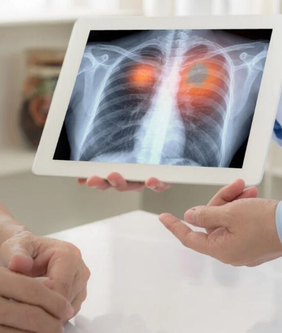 Piedmont to Launch Lung Transplant Program, Expanding Other