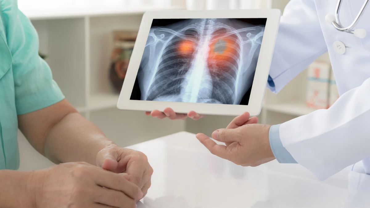 Piedmont to Launch Lung Transplant Program, Expanding Other