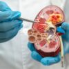 NKF Innovation Fund Invests